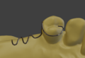 Ls4 1 klammer dreiarmig 03.png