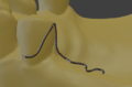 Ls4 1 klammer einarmig 05.png
