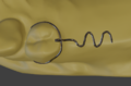 Ls4 1 klammer dreiarmig 04.png